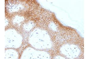 Formalin-fixed, paraffin-embedded human skin stained with Desmoglein-1 Monoclonal Antibody (DSG1/1733). (Desmoglein 1 抗体)