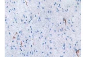 Immunohistochemistry (IHC) image for anti-Solute Carrier Family 12 (Sodium/Chloride Transporters), Member 3 (SLC12A3) (AA 3-146) antibody (ABIN7435784)