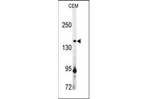 Western blot analysis: ADAMTS13 antibody staining of CEM cell line lysates (35 µg/lane). (ADAMTS13 抗体  (AA 836-866))