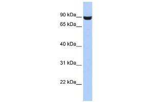 LRFN5 antibody used at 1 ug/ml to detect target protein. (LRFN5 抗体  (Middle Region))
