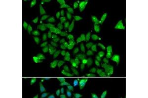 Immunofluorescence analysis of MCF-7 cells using ASPA Polyclonal Antibody (ASPA 抗体)