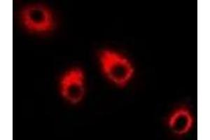 Immunofluorescent analysis of Eppin staining in HepG2 cells. (Eppin 抗体)