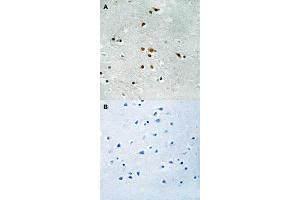 Immunohistochemical staining (Formalin-fixed paraffin-embedded sections) of human brain tissue with FER (phospho Y402) polyclonal antibody  without blocking peptide (A) or preincubated with blocking peptide (B) under 1:50-1:100 dilution. (FER 抗体  (pTyr402))