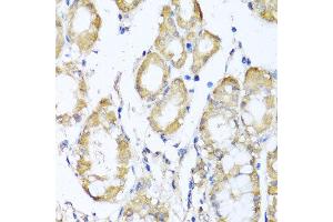 Immunohistochemistry (IHC) image for anti-Potassium Voltage-Gated Channel, Shal-Related Subfamily, Member 2 (KCND2) antibody (ABIN1882330)
