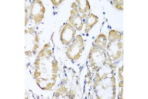 Immunohistochemistry of paraffin-embedded human stomach using KCND2 antibody at dilution of 1:100 (x40 lens). (KCND2 抗体)