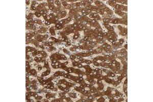Immunohistochemical staining (Formalin-fixed paraffin-embedded sections) of human liver with PYGL polyclonal antibody  shows strong cytoplasmic positivity in hepatocytes. (PYGL 抗体)