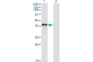 Western Blot analysis of NKX2-5 expression in transfected 293T cell line by NKX2-5 monoclonal antibody (M05), clone 4B11. (NK2 Homeobox 5 抗体  (AA 1-130))
