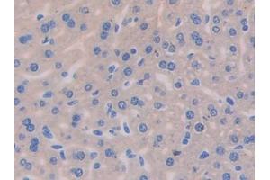 DAB staining on IHC-P; Samples: Mouse Liver Tissue (IL13 Receptor alpha 1 抗体  (AA 201-360))