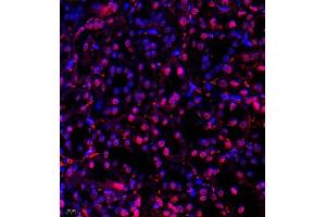 Immunofluorescence (Paraffin-embedded Sections) (IF (p)) image for anti-Ubiquitin Specific Peptidase 34 (USP34) antibody (ABIN7076115)