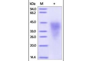 Human CD300c, His Tag on SDS-PAGE under reducing (R) condition.