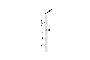 Anti-Rad9a Antibody (N-term) at 1:2000 dilution + M. (RAD9A 抗体  (N-Term))