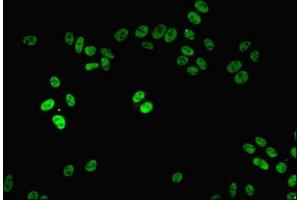 Immunofluorescent analysis of HepG2 cells using ABIN7161805 at dilution of 1:100 and Alexa Fluor 488-congugated AffiniPure Goat Anti-Rabbit IgG(H+L) (PPP1R8 抗体  (AA 1-209))