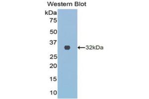 Western Blotting (WB) image for anti-Collagen, Type III, alpha 1 (COL3A1) (AA 1171-1435) antibody (ABIN1077676) (COL3A1 抗体  (AA 1171-1435))