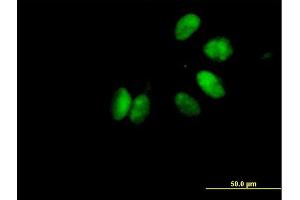Immunofluorescence of purified MaxPab antibody to CHEK2 on HeLa cell. (CHEK2 抗体  (AA 1-543))