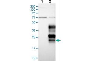 Western blot analysis of Lane 1: Negative control (vector only transfected HEK293T lysate), Lane 2: Over-expression Lysate (Co-expressed with a C-terminal myc-DDK tag (~3. (OPALIN 抗体)