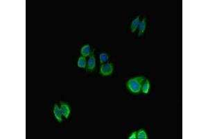 Immunofluorescent analysis of HepG2 cells using ABIN7161789 at dilution of 1: 100 and Alexa Fluor 488-congugated AffiniPure Goat Anti-Rabbit IgG(H+L) (NFATC1 抗体  (AA 48-406))