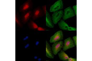 ABIN6260073 and ABIN6278423 staining  cells by IF/ICC.