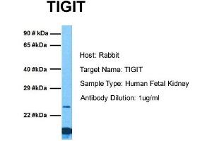 Host: Rabbit Target Name: TIGIT Sample Tissue: Human Fetal Kidney Antibody Dilution: 1. (TIGIT 抗体  (C-Term))