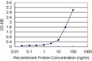 KHK (Human) Matched Antibody Pair