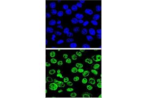 Confocal immunofluorescent analysis of MDM2 Antibody  (ABIN388067 and ABIN2845752) with Hela cell followed by Alexa Fluor® 488-conjugated goat anti-rabbit lgG (green).