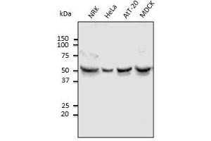 Anti-Tubulin alpha4A Ab at 1,000 dilution, lysates at 100 µg per Iane, Rabbit polyclonal to goat IgG (HRP) at 1/10,000 dilution. (TUBA4A 抗体  (N-Term))