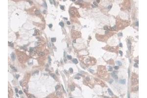 Detection of Nesp2 in Human Stomach Tissue using Polyclonal Antibody to Nesprin 2 (Nesp2)