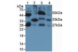 Western blot analysis of (1) Rat Serum, (2) Rat Lung Tissue, (3) Rat Intestine Tissue and (4) Rat Large Intestine Tissue. (IL-33 抗体  (AA 110-261))
