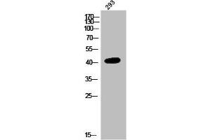 Western Blot analysis of 293 cells using NMBR Polyclonal Antibody (NMBR 抗体  (Internal Region))