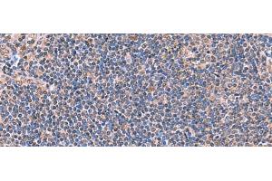 Immunohistochemistry of paraffin-embedded Human tonsil tissue using PEPD Polyclonal Antibody at dilution of 1:70(x200) (PEPD 抗体)