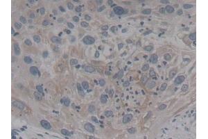 Immunohistochemistry (IHC) image for anti-Neurotrophic tyrosine Kinase, Receptor, Type 3 (NTRK3) (AA 32-429) antibody (ABIN7443641)