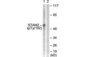 Western blot analysis of extracts from NIH-3T3 cells treated with EGF 200ng/ml 30', using STAM2 (Phospho-Tyr192) Antibody. (STAM2 抗体  (pTyr192))
