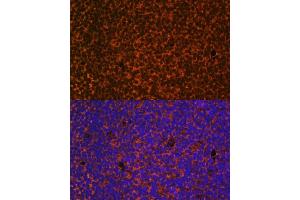 Immunofluorescence analysis of mouse embryos cells using PTCH1 antibody (ABIN1682368, ABIN1682367, ABIN3015342, ABIN3015343 and ABIN6213997) at dilution of 1:100. (Patched 1 抗体  (AA 1214-1312))
