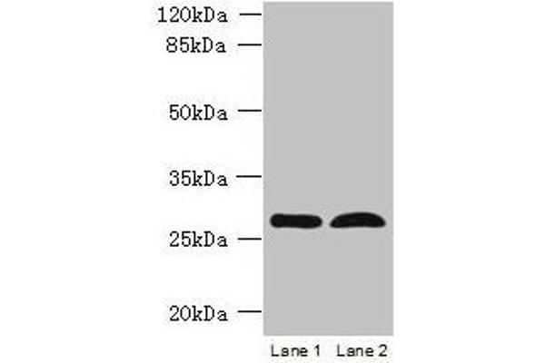 RTP4 抗体  (AA 1-224)