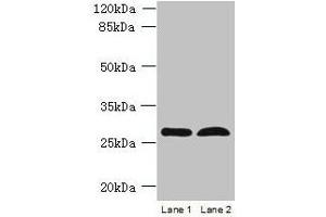Western blot All lanes: RTP4 antibody at 5 μg/mL Lane 1: K562 whole cell lysate Lane 2: Mouse thymus tissue Secondary Goat polyclonal to rabbit IgG at 1/10000 dilution Predicted band size: 28 kDa Observed band size: 28 kDa (RTP4 抗体  (AA 1-224))