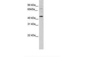Image no. 1 for anti-LIM Homeobox Transcription Factor 1, alpha (LMX1A) (AA 301-350) antibody (ABIN202392) (LMX1A 抗体  (AA 301-350))