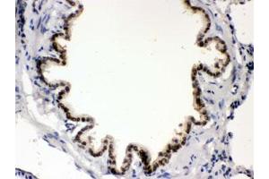 IHC testing of FFPE rat lung with BMP5 antibody. (BMP5 抗体)