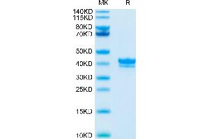 SDS-PAGE (SDS) image for Tumor Necrosis Factor Receptor Superfamily, Member 17 (TNFRSF17) (AA 1-53) protein (Fc Tag) (ABIN7273936)