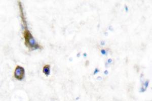Image no. 1 for anti-Potassium Voltage-Gated Channel, Shaw-Related Subfamily, Member 2 (KCNC2) antibody (ABIN271788) (KCNC2 抗体)
