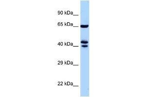 WB Suggested Anti-Zfp583 Antibody Titration: 1. (ZNF583 抗体  (Middle Region))