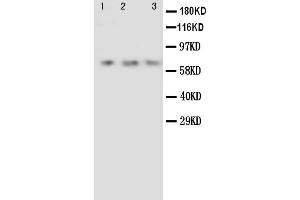 Anti-Angiopoietin 2 antibody, Western blotting Lane 1: Recombinant Human ANG2 Protein 10ng Lane 2: Recombinant Human ANG2 Protein 5ng Lane 3: Recombinant Human ANG2 Protein 2.