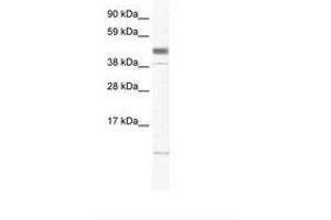 Image no. 1 for anti-Zinc Finger, Matrin-Type 1 (ZMAT1) (AA 359-408) antibody (ABIN6736003) (ZMAT1 抗体  (AA 359-408))