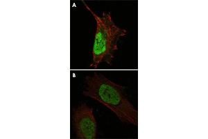 Confocal immunofluorescence analysis of cells using MDM4 monoclonal antobody, clone 2D10F4  (green). (MDM4-binding Protein 抗体)