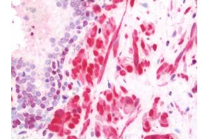 Anti-TAGLN / Transgelin / SM22 antibody IHC staining of human prostate. (Transgelin 抗体  (HRP))