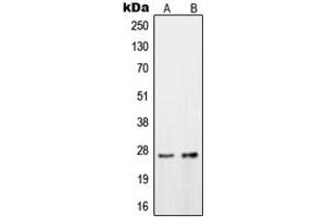 Western blot analysis of OTUB2 expression in HeLa (A), HepG2 (B) whole cell lysates. (OTUB2 抗体  (Center))