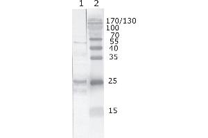 Western Blot testing of HIV-1 recombinant Tat protein. (HIV-1 Tat 抗体  (AA 71-81))