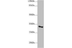 Western blot All lanes:SNRPA antibody at 9 μg/mL + Mouse liver tissue Secondary Goat polyclonal to rabbit IgG at 1/10000 dilution Predicted band size: 31 kDa Observed band size: 31 kDa (SNRPA1 抗体  (AA 8-278))
