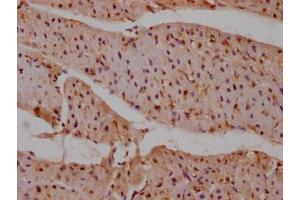 Immunohistochemistry (IHC) image for anti-Protein tyrosine Phosphatase, Non-Receptor Type 11 (PTPN11) antibody (ABIN7127807)