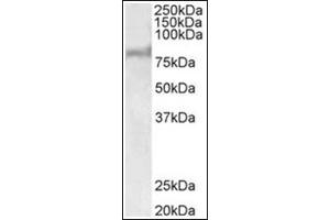 Western Blotting (WB) image for anti-ATP-Binding Cassette, Sub-Family D (ALD), Member 2 (Abcd2) (AA 460-473), (Internal Region) antibody (ABIN1105183) (Abcd2 抗体  (Internal Region))