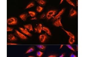 Immunofluorescence analysis of U2OS cells using DPP4 Polyclonal Antibody at dilution of 1:100. (DPP4 抗体)
