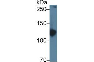 Western Blot; Sample: Rat Serum; Primary Ab: 1µg/ml Rabbit Anti-Rat AMPH Antibody Second Ab: 0. (Amphiphysin 抗体  (AA 24-240))
